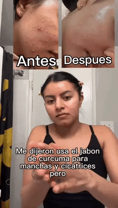 Jabón de Cúrcuma - Promoción 3+1